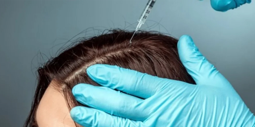 best hair prp treatment for Hair and skin at atomic clinic