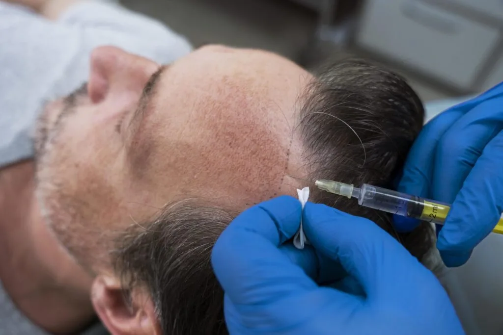 Prp Therapy Atomic Clinic