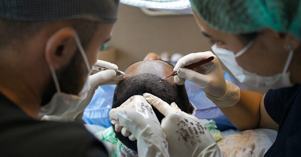 hair transplant in Jaunpur