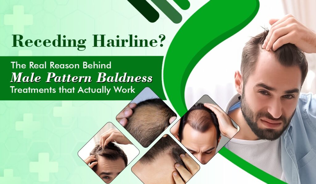 Male Baldness - Atomic Clinic