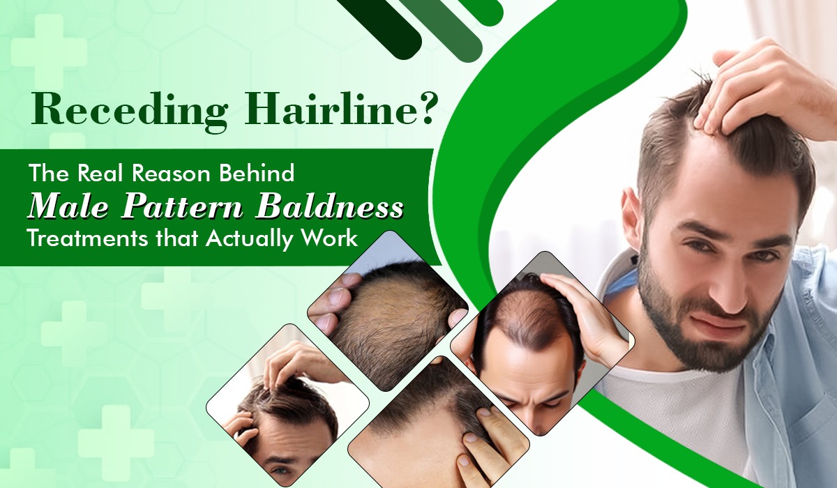 Male Baldness - Atomic Clinic