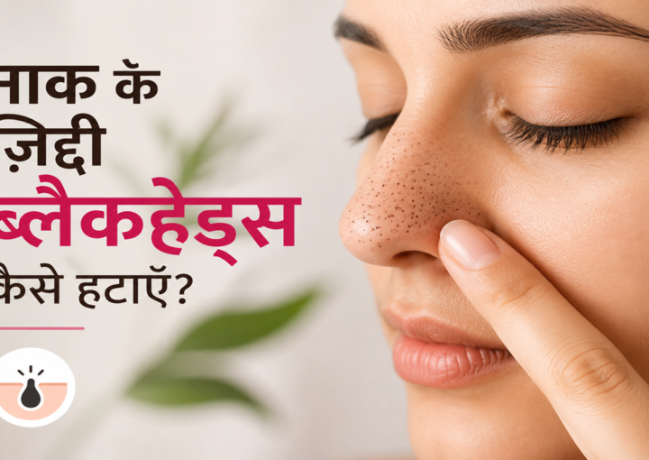 nose blackheads remove -atomic clinic