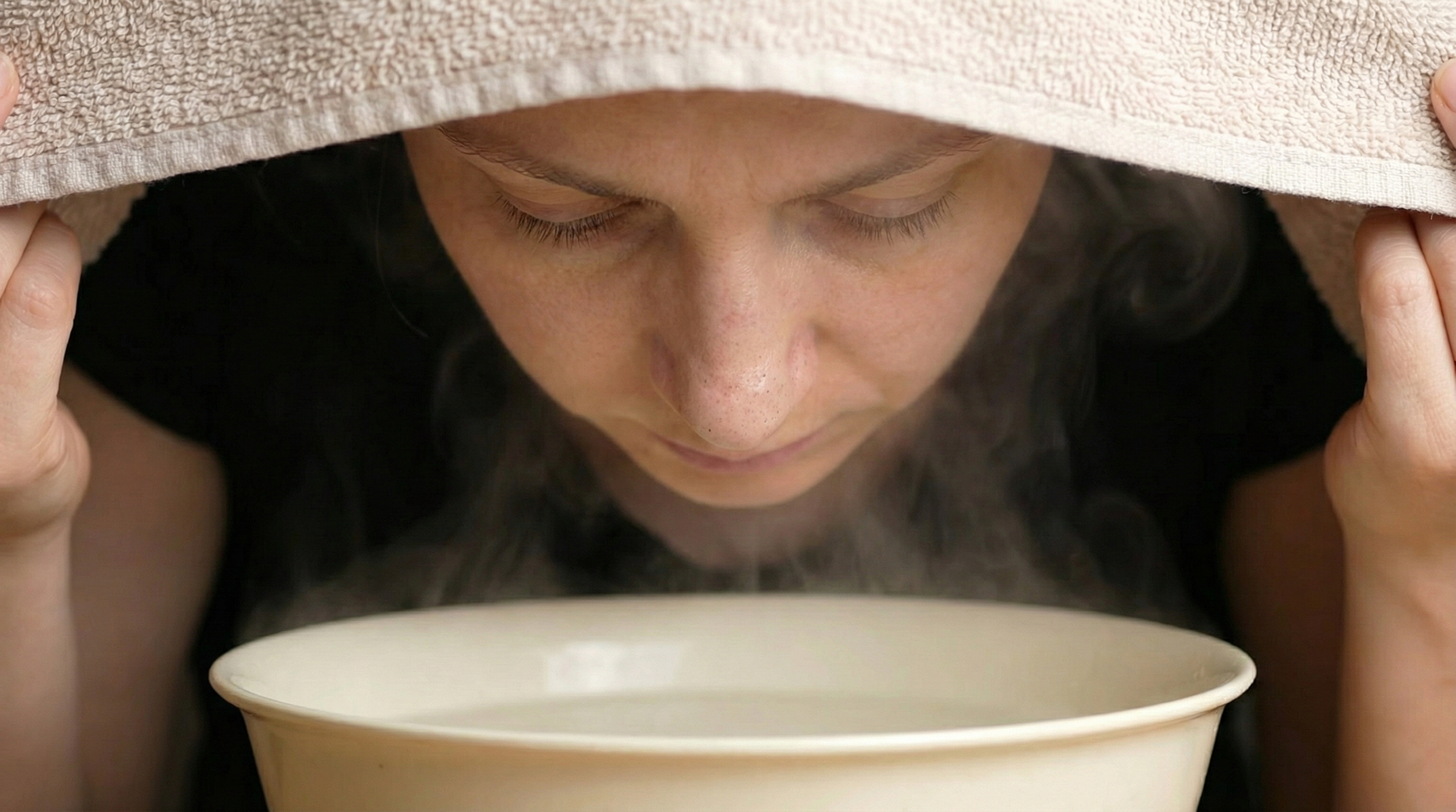 blackheads cure in varanasi - Atomic Clinic