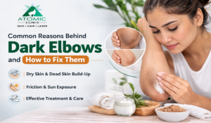 dark elbow treatment in Atomic Clinic Varanasi