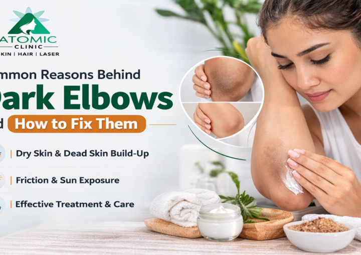 dark elbow treatment in Atomic Clinic Varanasi