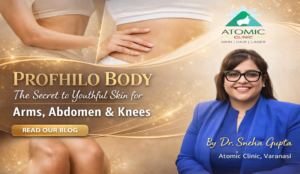 Profhilo body in varanasi - atomic clinic