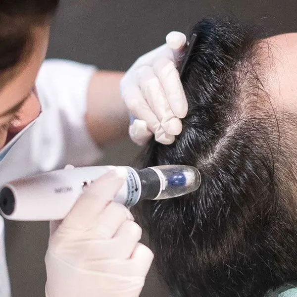 Hair Care Treatment