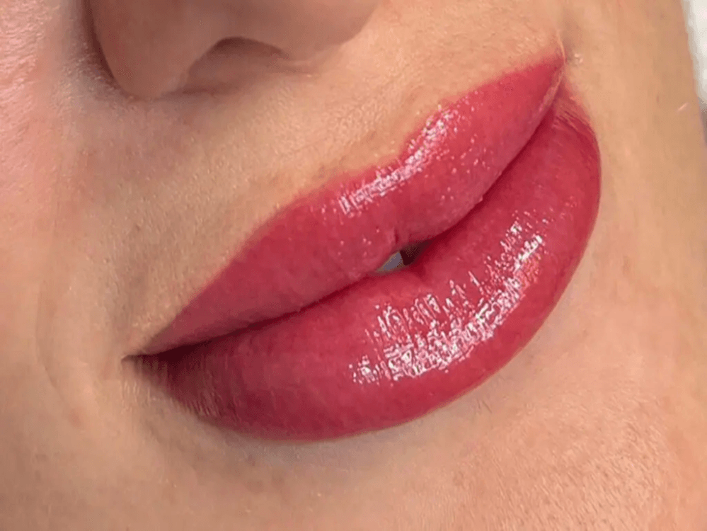 Lip Pigmentation