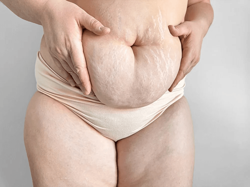 Post Pregnancy care